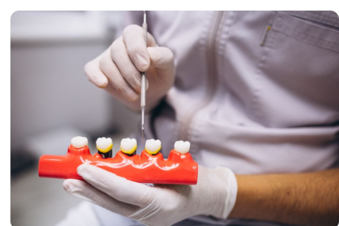 zirconia and titanium implants which is best for patients at diagnopein